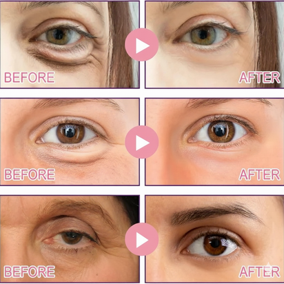 Aurela Collagen Micro-Eye Patch