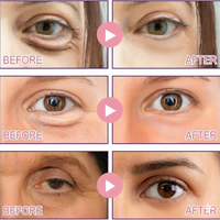 Aurela Collagen Micro-Eye Patch